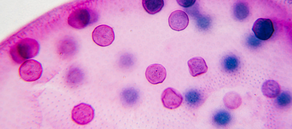 The role of CoQ10 in mitochondrial health