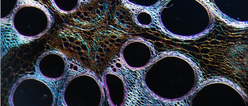 Thumbnail for Does stress cause cell death?