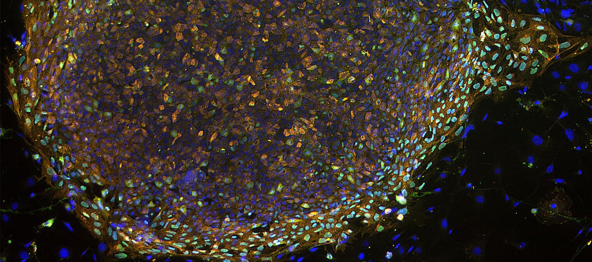 Meet your stem cells